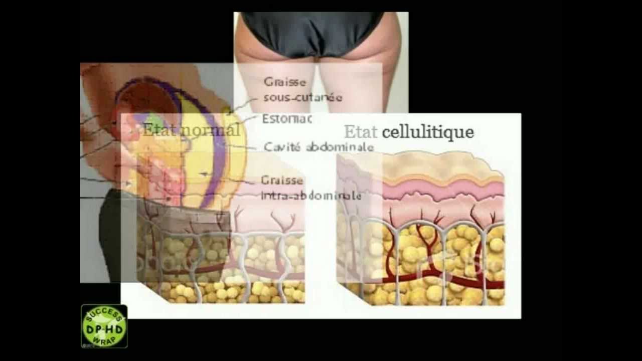 travail a domicile wrap
